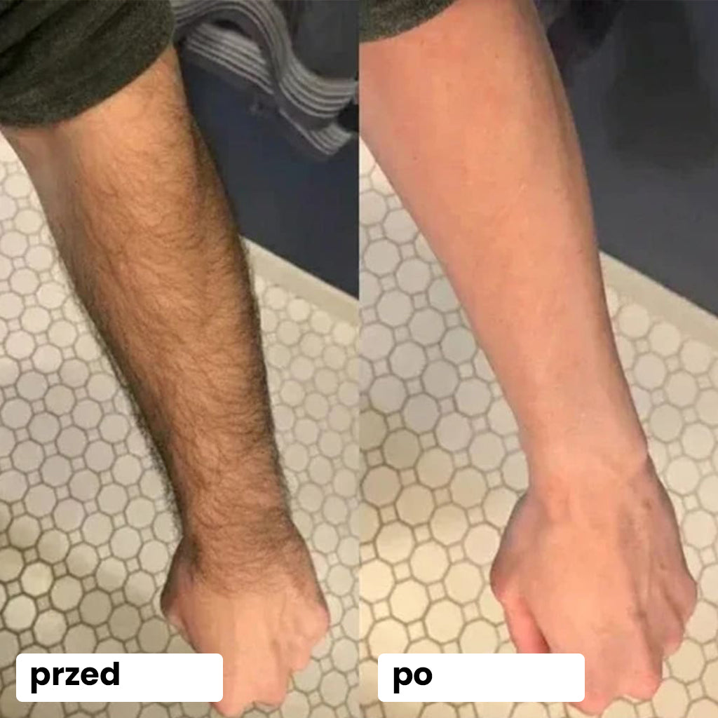 spray do depilacji